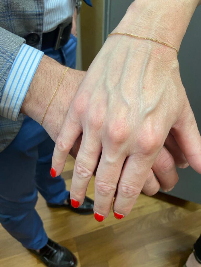 Bracciale a cuore gonfio in oro 14k / Catena a maglie spesse con ciondolo audace, dichiarazione pesante - Italia